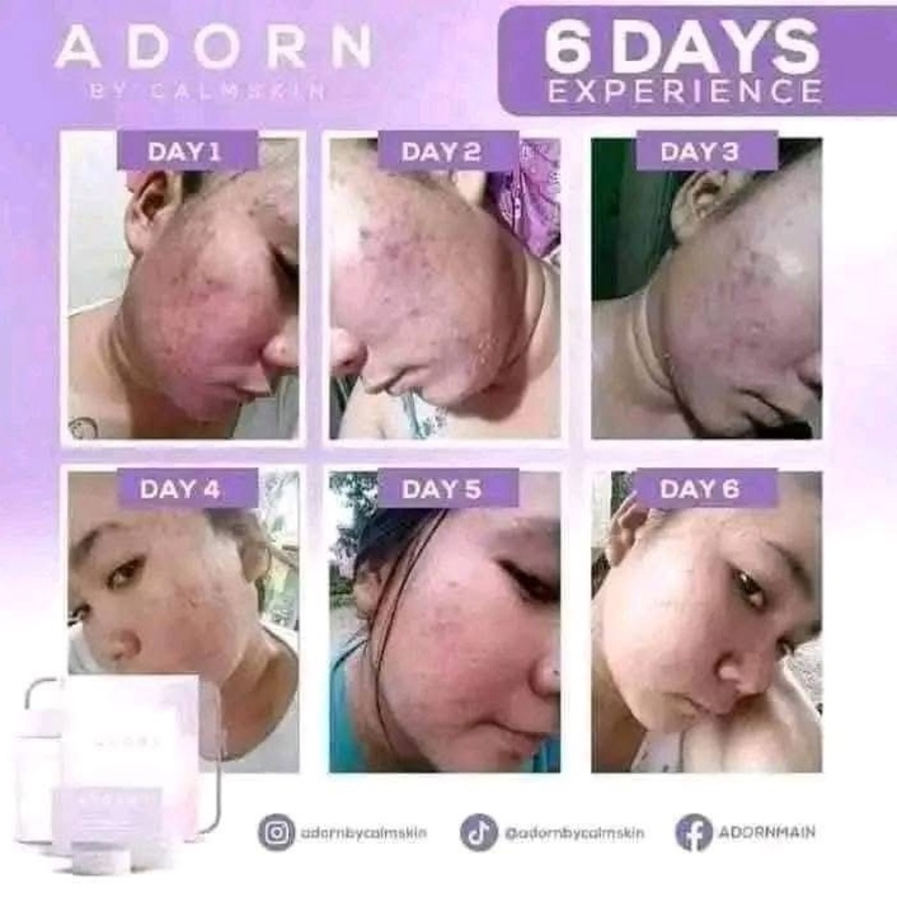 Adorn Rejuvenating Skincare Set - Picture 8 of 12